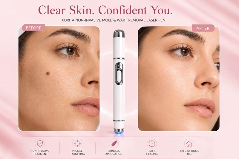 Xorita Non-Invasive Mole & Wart Removal Pen – Painless Laser Skin Tag Remover, 1PC"